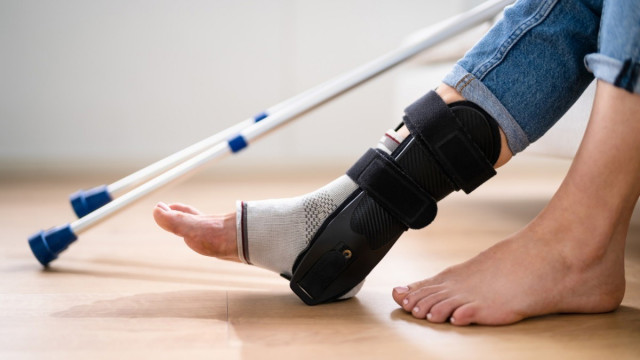 Esguince de tobillo.