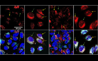 En rojo, el fármaco después del tratamiento térmico se dispersa por la célula y alcanza el núcleo (en azul).