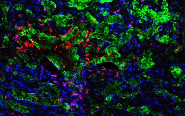 Archivo - El CNIO identifica cómo las células tumorales reprograman el cerebro para favorecer la metástasis