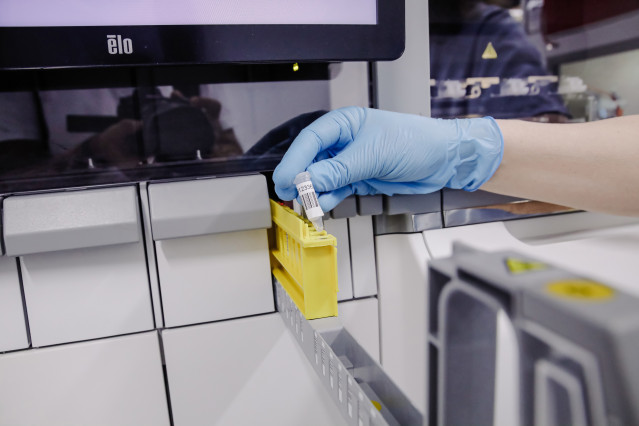 Archivo - Una técnico de laboratorio extrae el material genético del virus de la viruela del mono, en el Hospital Ramón y Cajal, a 30 de mayo de 2022, en Madrid (España). La Comunidad de Madrid empieza hoy a realizar en cinco hospitales públicos de la reg