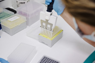Archivo - Una técnico de laboratorio extrae el material genético del virus de la viruela del mono, en el Hospital Ramón y Cajal, a 30 de mayo de 2022, en Madrid (España). La Comunidad de Madrid em