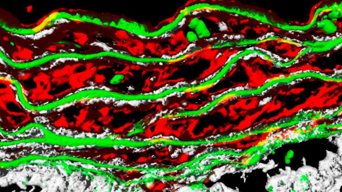 Detalle de la pared de la aorta en un modelo experimental de síndrome de Marfan.