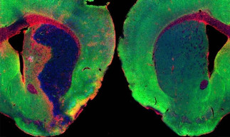 Un estudio liderado por el CSIC revela que una molécula del organismo reduce inflamación y daño cerebral tras ictus