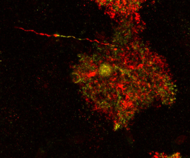Un estudio internacional con intervención del CSIC halla células cerebrales patológicas hasta ahora consideradas inocuas