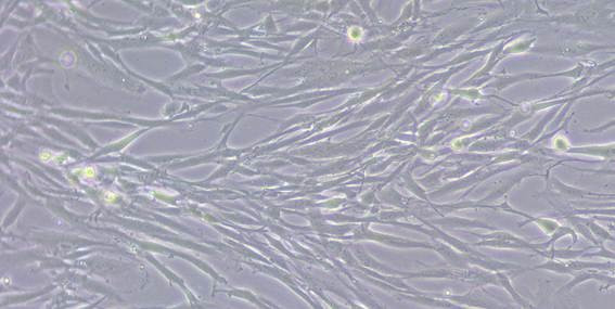 Fibroblastos actúan como escudo en cáncer de vías biliares intrahepático para resistir a quimioterapia, según un estudio