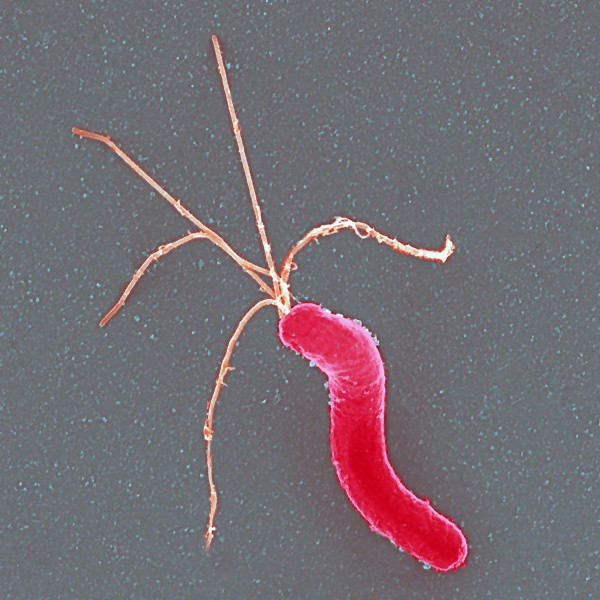 Archivo - Helicobacter pylori es una bacteria que infecta el epitelio gástrico humano.