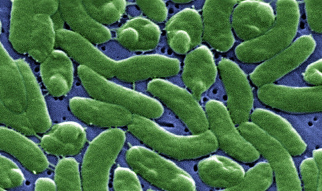 Imagen al microscopio, coloreada, de la bacteria 'Vibrio vulnificus'.