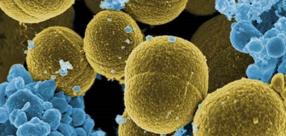 Bacteria ‘Staphylococcus aureus’ escapando de la destrucción por células blancas humanas.