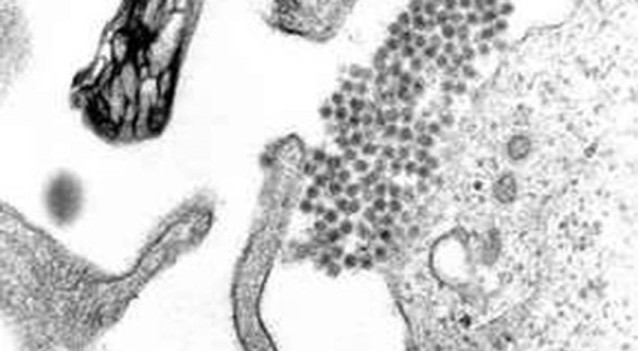 Partículas virales del dengue.